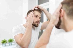 Junger Mann denkt über eine Haartransplantation nach