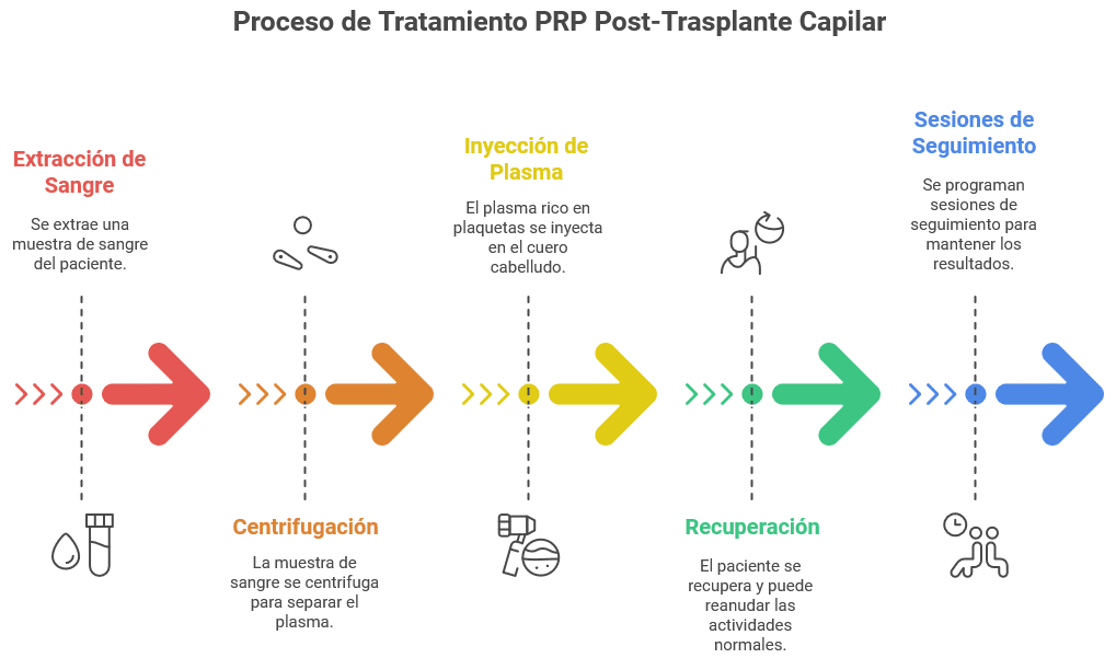 Ilustración del proceso de tratamiento PRP aplicado en el cuero cabelludo tras un trasplante capilar, mostrando la inyección de plasma rico en plaquetas para estimular el crecimiento del cabello