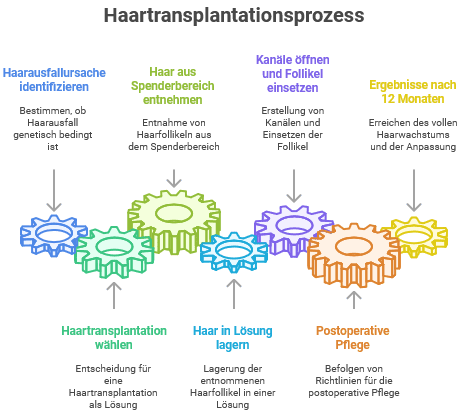 Grafische Veranschaulichung des Haartransplantationsprozesses